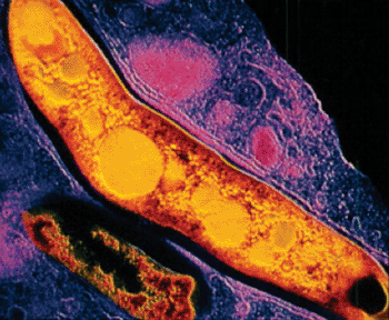 Image: Mycobacterium tuberculosis (Photo courtesy of the University of Wisconsin).